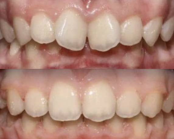 Dentalknysh Ортодонт брекети елайнери Львів - зображення 1