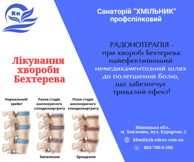 Лікування хвороби Бехтерева у санаторії «хмільник» Хмільник - зображення 1