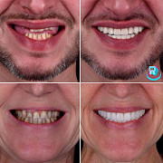 Мережа стоматологічних клінік Са-ната: послуги стоматологів у Києві Київ